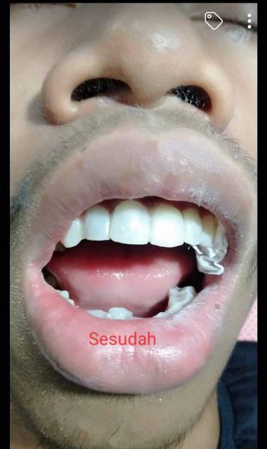 WhatsApp Image 2025-02-13 at 19.58.41